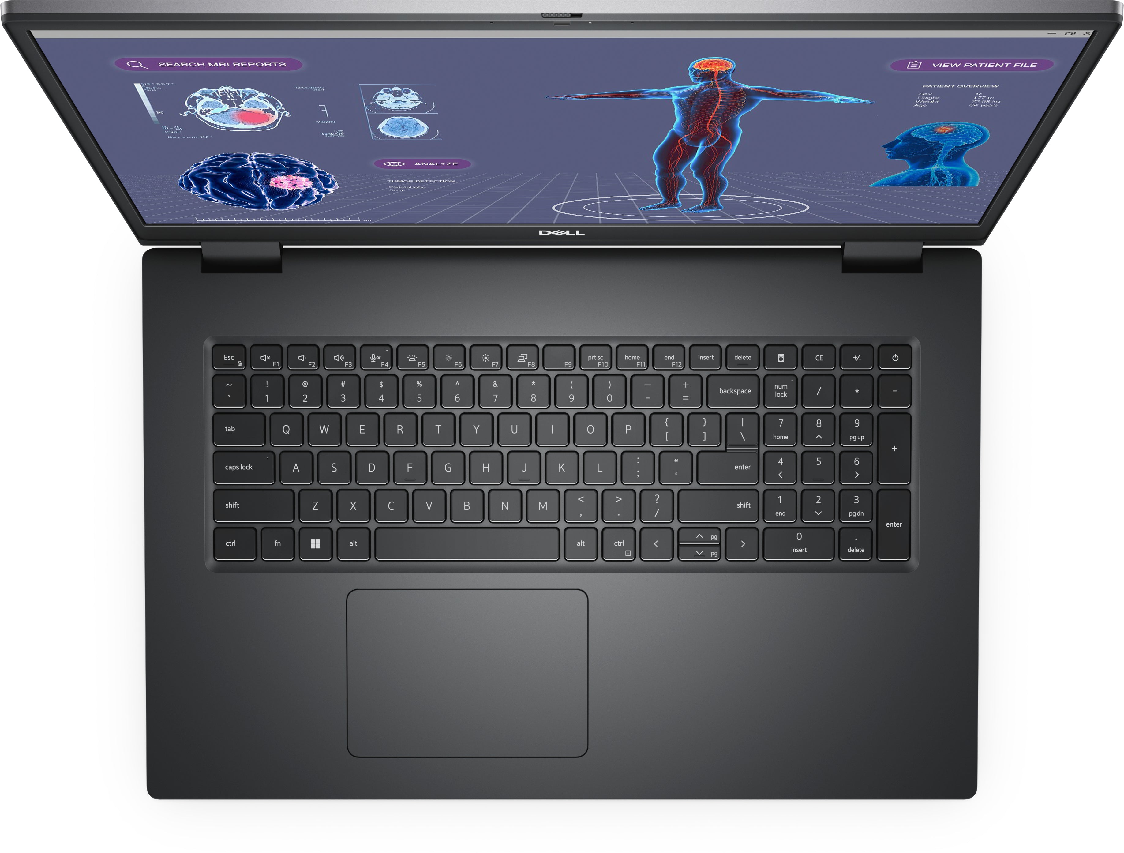 DELL Precision 7780 Intel® Core™ i9 i9-13950HX Mobile workstation 43.9 cm (17.3") Full HD 64 GB DDR5-SDRAM 1 TB SSD NVIDIA RTX 3500 Ada Wi-Fi 6E (802.11ax) Windows 11 Pro Grey (3GK6N) - Cartouches Certifiees